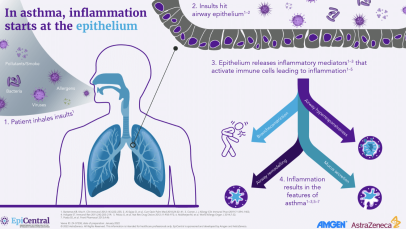 Introduction to the airway epithelium - infographic