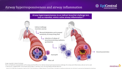 Measuring airway hyperresponsiveness