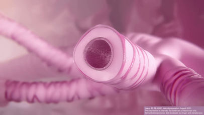 Pathological changes and symptoms of asthma - 3D animation