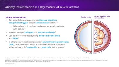 The fundamentals of airway immunology in severe asthma_no icon