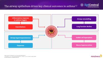 The role of the airway epithelium as a critical immune-functioning organ