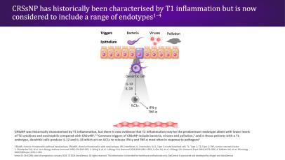 Slide image describing how CRSsNP has historically been characterised by T1 inflammation but is now considered to include a range of endotypes