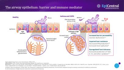 Examine the impact of environmental triggers on epithelial barrier dysfunction thumbnail