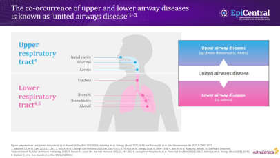 The implications of epithelial activation across the upper and lower airway