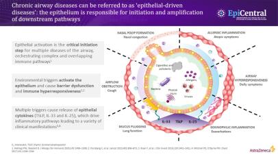 Slide describing the role of the epithelium in the initiation and amplification of inflammatory pathways