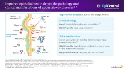 Slide illustrating how impaired epithelial health contributes to the development and clinical features of upper airway disease