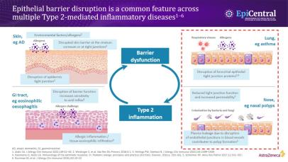 Slide explaining the role of epithelial barrier dysfunction on Type 2 inflammatory diseases