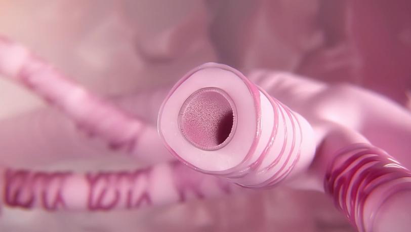 Pathological changes and symptoms of asthma image