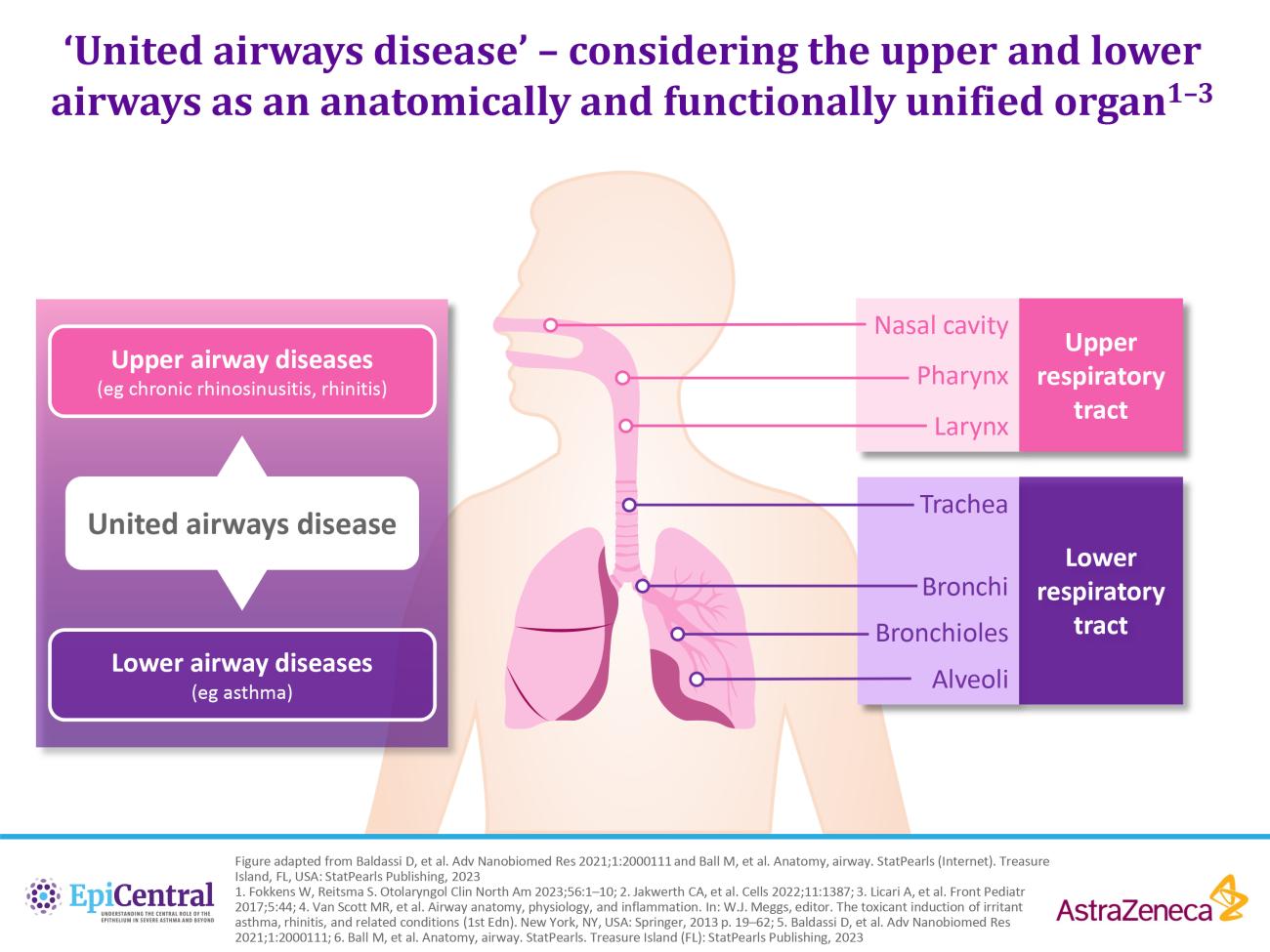 United airways disease infographic