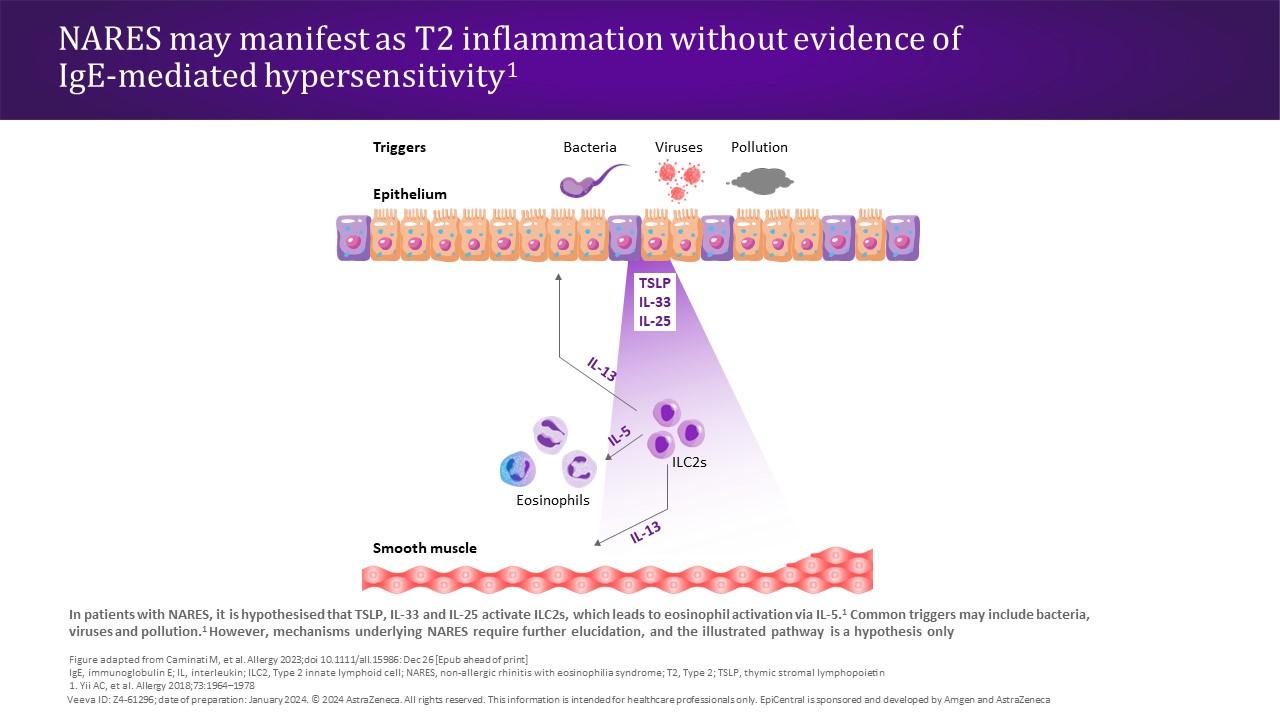 NARES may manifest as T2 inflammation without evidence of IgE-mediated hypersensitivity