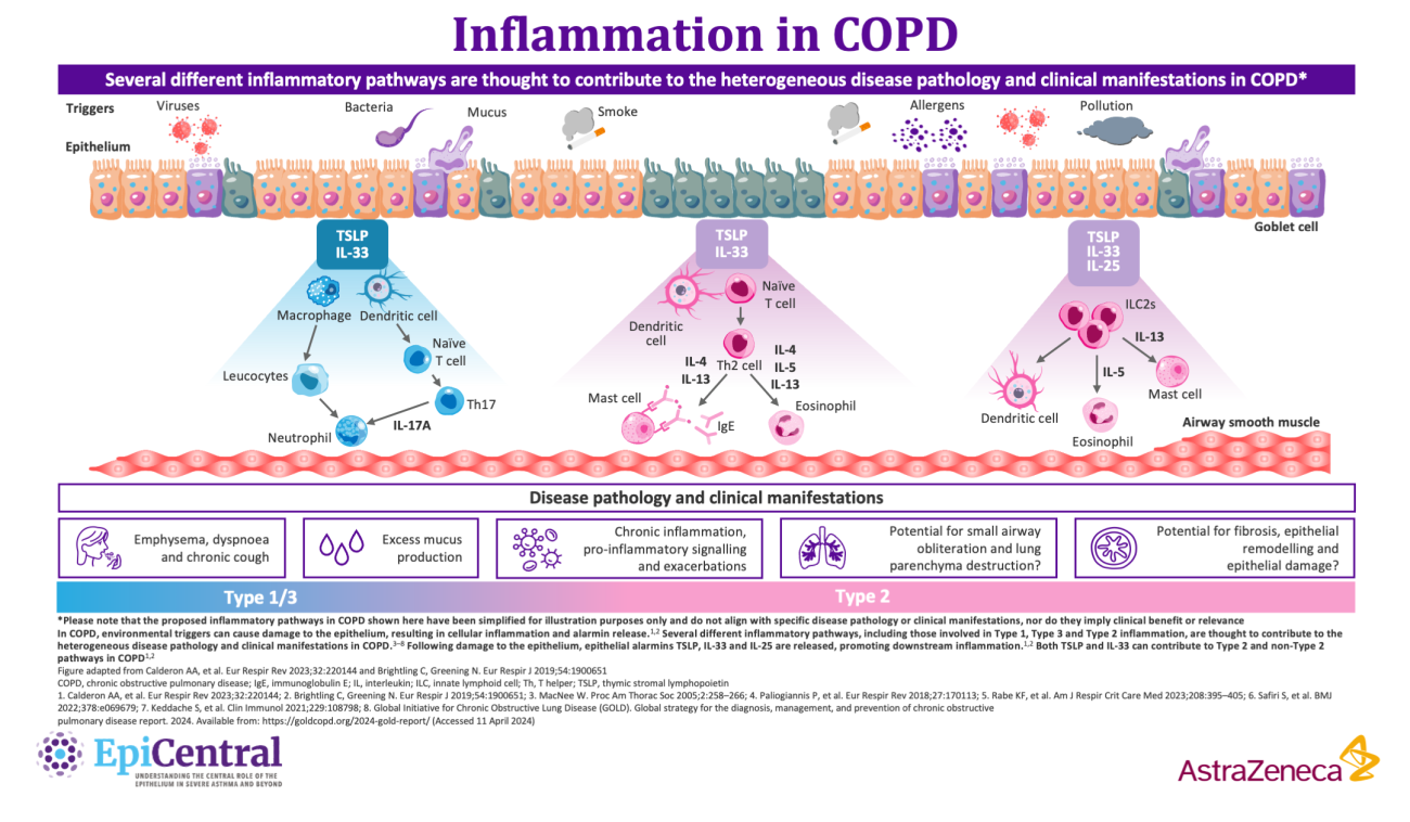 EpiCentral Global COPD Simplified Inflammatory Cascade Infographic