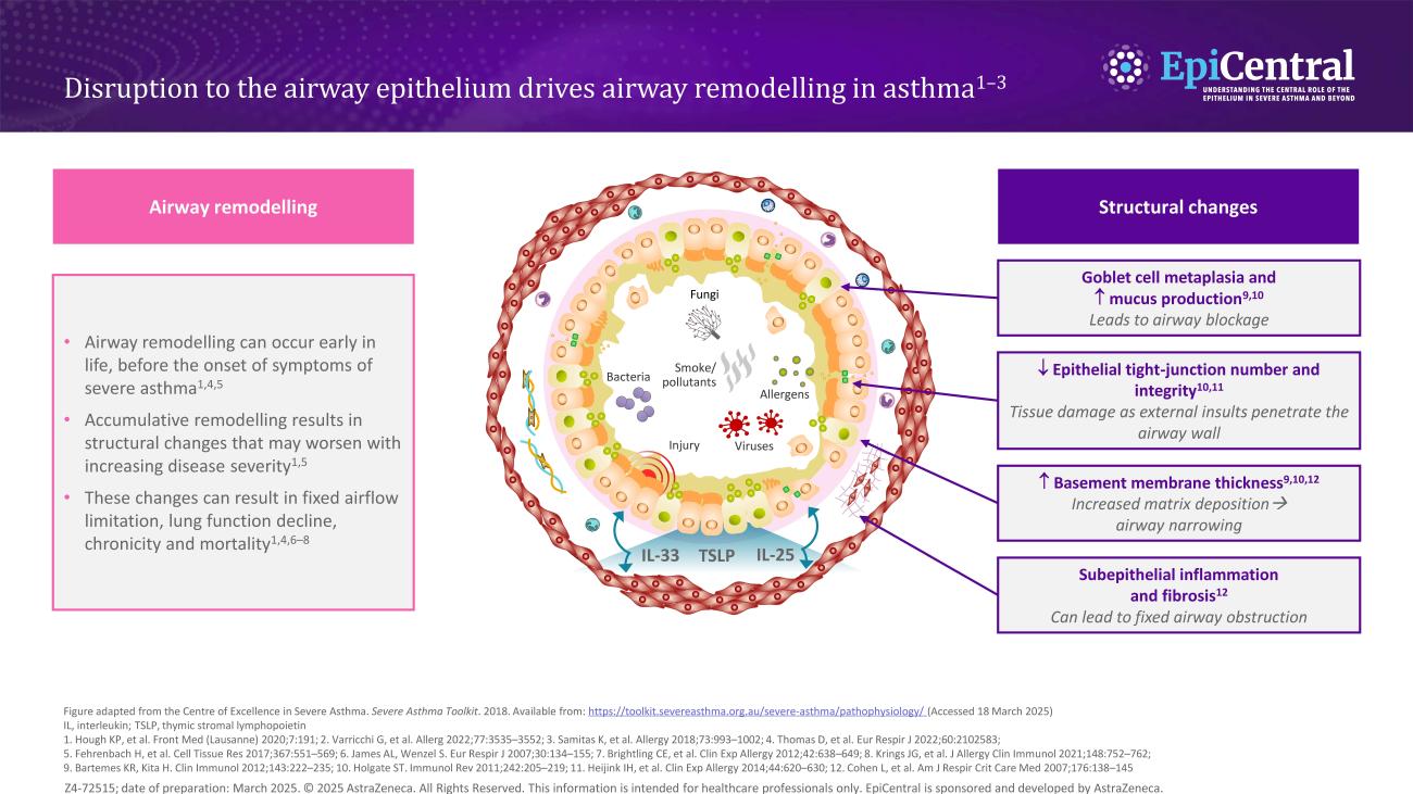Image disruption to epithelium drives remodelling